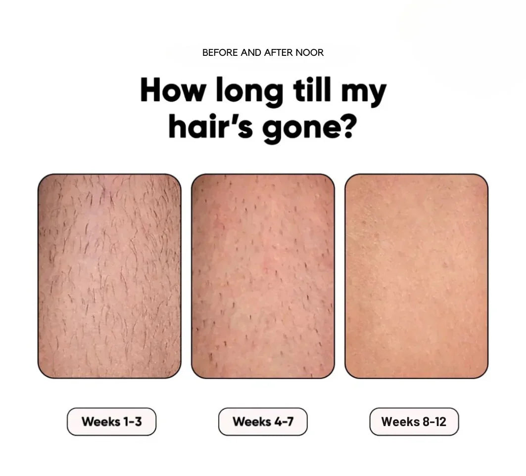 GlowSilk IPL Hair Removal Handset – Smooth Skin at Home